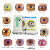 Máquina de Análisis de Iris, Cámara Oftalmológica de 12 MP con Software de Prueba, Analizador de Iris para Uso Doméstico, Escáner de Salud con Imágenes HD