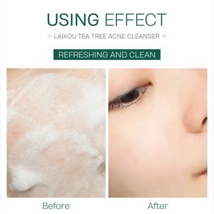 LAIKOU 50g Crema Facial Natural Orgánica de Marca Privada para el Cuidado de la Piel con Árbol de Té, Limpiador para el Acné y Control de Grasa - Product Image 6