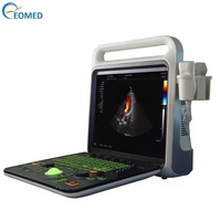 Gerçek Zamanlı Renkli Doppler Ultrason Sonografi Kardiyak Doppler Eko Tıbbi Ultrason Tarayıcı CU60B