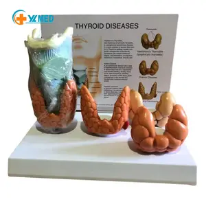 Thyroid Pathology Model Endocrinology Thyroid Disease Display Model Sold As Medical Science Anatomical Model