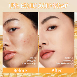 Sabun roishun dengan asam Kojic untuk memutihkan kulit dan menghilangkan jerawat - Product Image 3