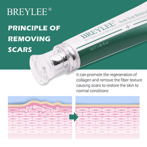 <span class=keywords><strong>BREYLEE</strong></span> Marca Reduce Visiblemente Cicatrices Eliminación de Acné Crema de Estrías Profundas Adultos Herbal Crema de eliminación de cicatrices de acné femenino SS - Product Image 4