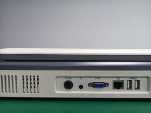 BPU50 le plus populaire médical Portable Doppler ultrasons Machine B/W ultrasons système de Diagnostic ordinateur portable Ecograph - Product Image 5