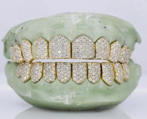 Grillz personnalisés exclusifs en argent sterling 925 avec moissanite taille brillant, aspect diamant, pour un style quotidien - Product Image 4
