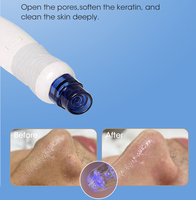 Máquina de Hidrofacial Coreana, Hidrodermoabrasión, Terapia de Hidrógeno y Oxígeno, Hidrafacial Profesional de Agua 7 en 1