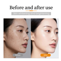Ensemble de soins éclaircissants à la vitamine C OEM avec nettoyant, tonique, sérum et crème, routine en 4 étapes pour un blanchiment visible et une peau éclatante