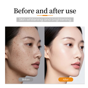 Set Skincare Illuminante alla Vitamina C OEM con Detergente, Tonico, Siero e Crema - Routine in 4 Fasi per una Pelle Visibilmente Più Chiara e Luminosa - Product Image 6
