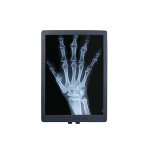 Japonya <span class=keywords><strong>Fuji</strong></span> diş e-hız <span class=keywords><strong>x-ray</strong></span> EIZO LB190E01 SL01 R190E5-L01 NL128102BM29-05 gri tonlamalı tıbbi ekran hurda <span class=keywords><strong>film</strong></span>  - Product Image 2