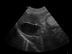 Escáner Veterinario SonoScape E1V, Máquina <span class=keywords><strong>de</strong></span> Ultrasonido Portátil en Blanco y Negro, Sonda <span class=keywords><strong>de</strong></span> Ultrasonido Sonoscape, Económico y Rentable - Product Image 6