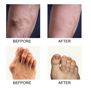 เพอร์เฟคซ์ คอลลาเจน บรรเทาอาการบวมและปวดข้อสำหรับผู้ที่เป็นโรคข้ออักเสบ ครีมนวดข้อ<span class=keywords><strong>เข่า</strong></span>และกล้ามเนื้อ - Product Image 3