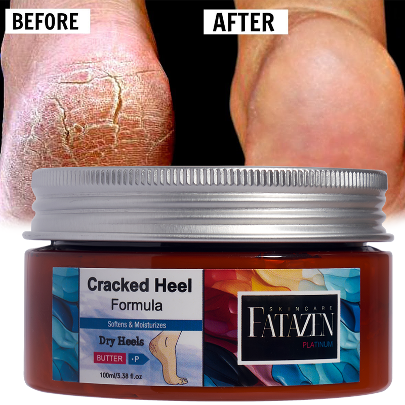 Natural Moisturizing Hand Foot Cream Feet