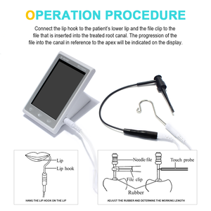 Equipo Dental Portátil Tipo Batería, Localizador de Ápice MicroPex Mini para Endodoncia y Tratamiento de Conducto Radicular - Product Image 4