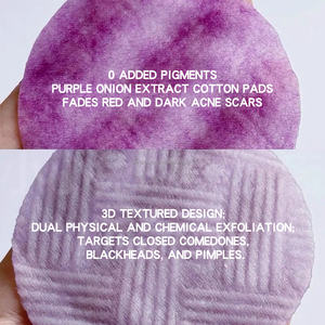 Almohadillas Exfoliantes <span class=keywords><strong>de</strong></span> Extracto <span class=keywords><strong>de</strong></span> Cebolla <span class=keywords><strong>de</strong></span> Marca Privada OEM, Tónico Facial Aclarante para el Cuidado <span class=keywords><strong>de</strong></span> la Piel, Almohadillas Exfoliantes para el Tratamiento del Acné - Product Image 5