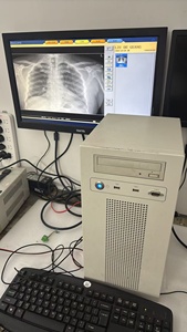 Équipement médical d'échographie couleur <span class=keywords><strong>DR</strong></span> 9-1402-3542 9-1101-3578 PCI-CAN-BUS HG2-6300P 38001-0000-15-1HD1 38001-0000-20-2KE1 - Product Image 3