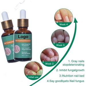 Logotipo personalizado/etiqueta privada 30ML Solución de aceite de reparación de <span class=keywords><strong>uñas</strong></span> Renovación y tratamiento de infecciones para hongos <span class=keywords><strong>en</strong></span> <span class=keywords><strong>las</strong></span> <span class=keywords><strong>uñas</strong></span> - Product Image 3