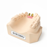 Pont dentaire en zircone personnalisé Ecolab pour les laboratoires dentaires et les cliniques, certifié ISO 9001, durable, ajustement parfait, restauration complète de la bouche, professionnel