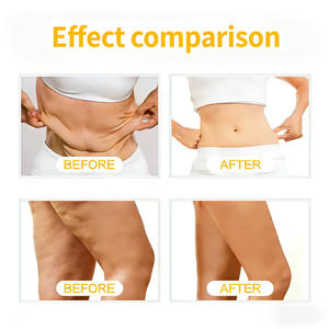 Crema Moldeadora de Cúrcuma OEM, Extracto de Cúrcuma, Crema Reafirmante Herbal Natural, Mejora la Elasticidad de la Piel para Reafirmar Todo el Cuerpo - Product Image 4