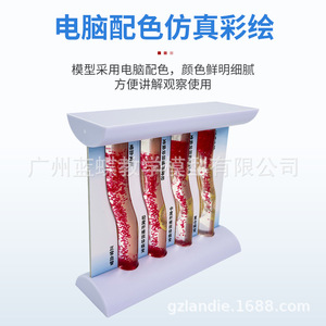 Modèle de simulation vasculaire d'occlusion et d'hyperlipidémie ; dynamiques pathologiques de l'athérosclérose et de la thrombose artérielle ; - Product Image 5