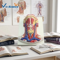 Modèle d'anatomie médicale en plastique du col de l'utérus avec muscles
