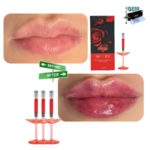 Relleno Labial Rojo Premium OEM <span class=keywords><strong>de</strong></span> 24 mg/ml <span class=keywords><strong>con</strong></span> Vitamina B12 Monofásica <span class=keywords><strong>de</strong></span> 1 mg/ml y HA Reticulado para <span class=keywords><strong>Aumento</strong></span> <span class=keywords><strong>de</strong></span> <span class=keywords><strong>Labios</strong></span> en Forma <span class=keywords><strong>de</strong></span> M, Relleno <span class=keywords><strong>de</strong></span> 1 ml - Product Image 1