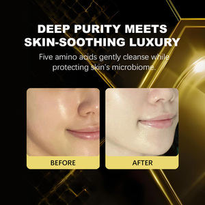 <span class=keywords><strong>Limpiador</strong></span> suave de aminoácidos, Control de <span class=keywords><strong>aceite</strong></span>, lavado <span class=keywords><strong>Facial</strong></span>, Limpieza Profunda, espuma <span class=keywords><strong>Facial</strong></span>, <span class=keywords><strong>limpiador</strong></span> hidratante para pieles sensibles grasas - Product Image 4