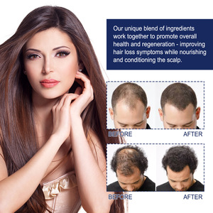 Hair Follicles Nutrients and <b>Oxygen</b> Providing Shiny Smooth Resilient and Dense Hair Creating Hair Oil - Product Image 4