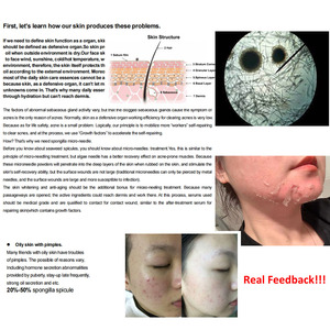 Perawatan Kulit Wajah Premium Algae Peel Spongilla Spicules Peeling De Algas Marinas Anti-Jerawat dan Perawatan Kulit Berbintik - Product Image 3