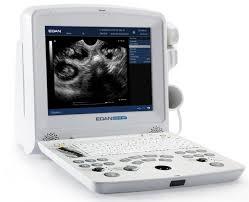 Máquina de Ultrasonido Veterinaria Portátil Edan DUS 60 con Batería Integrada y Certificación CE para Diagnóstico Animal - Product Image 6