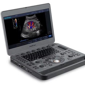 Equipo de Ultrasonido Doppler Color Portátil de Alta Gama Sonoscape X3V con Monitor LCD a Color de Alta Resolución de 15.6 Pulgadas - Product Image 2