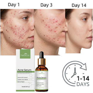 Suero Antiacné con 2% de Ácido Salicílico, BHA, Niacinamida, Tratamiento Facial, Elimina Cicatrices, Atenúa Marcas de Acné, Reduce el Enrojecimiento, Marca Privada OEM - Product Image 1