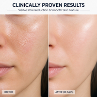 Essence liquide pour le visage à l'acide lactique naturel, vente en gros, très demandée, capable de réduire les pores, atténuer les ridules et éclaircir le teint.