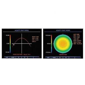 Alta Qualidade Autorefractor RMK-700 Refratômetro Automático Aprovado com Keratometer para Venda - Product Image 5