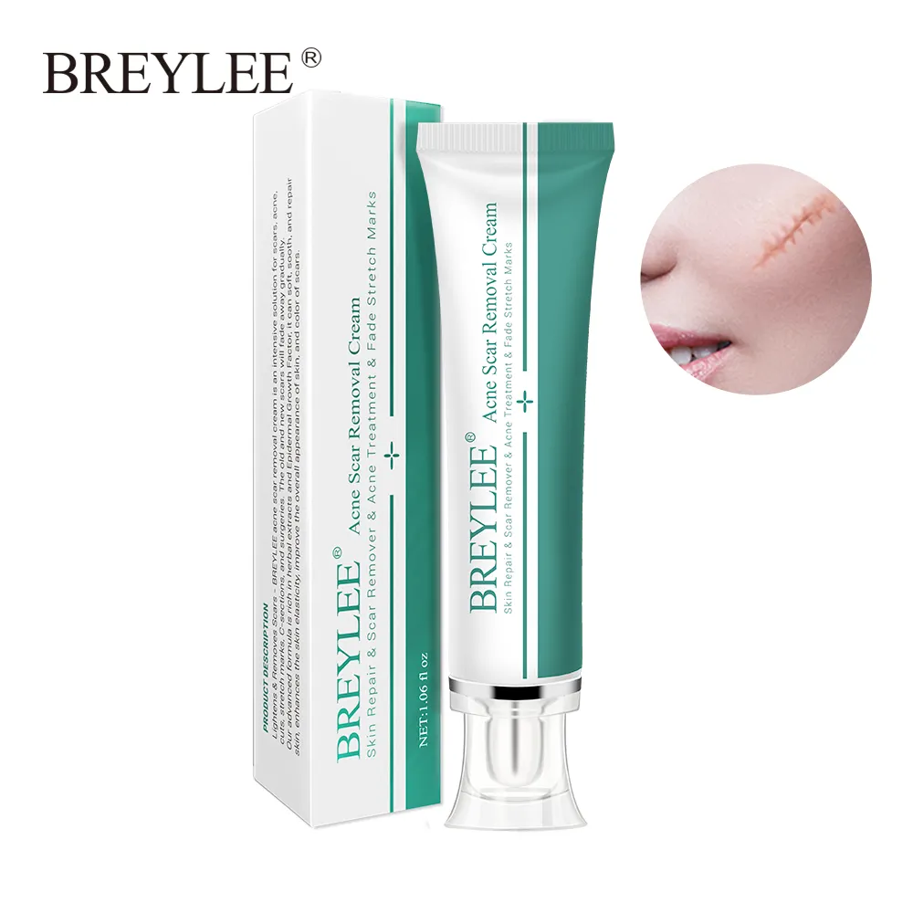 BREYLEE Acne Cicatriz Remoção Creme 30g Creme Rosto Reparação Da Pele Cuidados Com A Pele Cicatriz Acne Tratamento Remover Estrias Branqueamento Creme