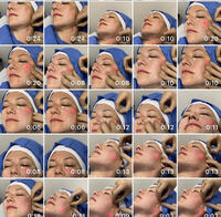 Triangel Appareil professionnel de liposuccion et de perte de poids par laser diode 980nm 1470nm, Endolaser pour lifting du visage et amincissement