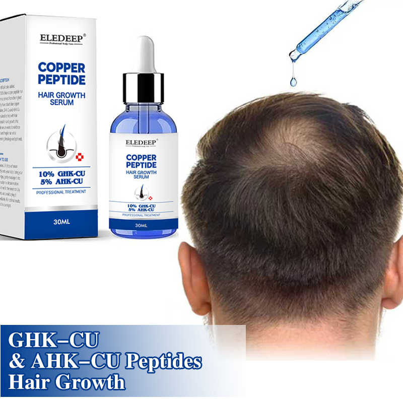S 10% GHK-CU+5% AHK-CU Blue Copper Peptide Scalp Nutrient Solution Hair  Strengthening Serum for Follicle Activation Scalp Repair| Alibaba.com