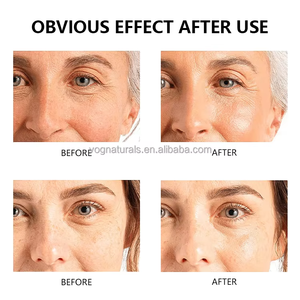 Crema Facial Ligera, Hidratante, Iluminadora, Reafirmante, Antienvejecimiento y Nutritiva, 50 ml, No Grasosa, para Todo Tipo de Piel - Product Image 5