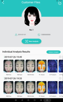 Machine d'analyse intelligente de la peau du visage, analyse de la couleur de la peau du nez, caméra HD 16MP, numérisation rapide en 20 secondes, rapport avant-après en PDF