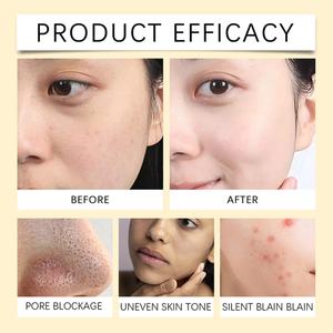 Mascarilla Facial de Arcilla con Vitamina C y Cúrcuma para Limpieza Profunda, 120g, Venta al Por Mayor - Product Image 2