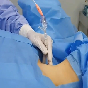 Equipo de Cirugía Láser de Diodo de 1470nm y 980nm para Descompresión Láser Percutánea (PLDD) de Hernias Discales y Hernias Cervicales - Product Image 6