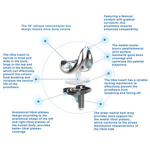 CANWELL, componente femoral, artroplastia, prótesis de articulación de rodilla, prótesis artificial PS CoCrMo, Kit de reemplazo de rodilla <span class=keywords><strong>total</strong></span> primario - Product Image 4