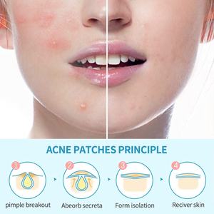 Parche curativo de emergencia para árbol de té, granos de acné, de Corea, Oem - Product Image 3