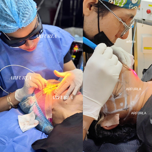 Endoláser 2026 de Última Generación 980nm 1470nm para Lifting Facial y Lipólisis, Eliminador de Grasa - Product Image 2