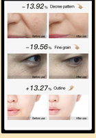 Haute qualité portable Nano oxygène Jet brume compresse froide masseur facial Anti-âge visage dispositif avec prise USB produit de beauté
