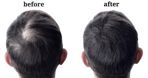 ระบบผม PU แบบ Vloop ขนาด 0.06 มม. เส้นผมธรรมชาติ จัดส่งรวดเร็ว - Product Image 5