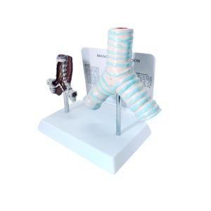 Modelo Comparativo de Tráquea Humana Saludable y Tráquea Dañada por el Tabaco - Product Image 1