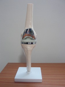 Hoogwaardig PVC afneembaar kunstmatig klein dubbel zilveren kniegewricht implantaat modelset medisch wetenschappelijk oefenmodel voor protheses - Product Image 6