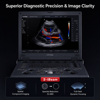 Sistem USG Doppler Warna Portabel Laptop untuk Diagnostik Medis dan Pencitraan Klinis Digital Veteriner