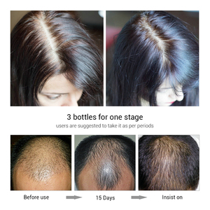 LANBENA Aceite Esencial Orgánico de Jengibre para el Crecimiento del Cabello, Spray de Suero para el Tratamiento de la Caída del Cabello - Product Image 6