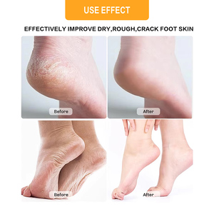 Ensemble de soin des pieds 2-en-1 Vegan et sans parabène, à base de plantes hydratantes, avec <span class=keywords><strong>boue</strong></span> de pédicure, sel de la Mer Morte et huile d'ému, pour talons fendillés et callosités - Product Image 5