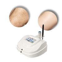 Máquina de Depilación por Electrólisis con Certificación CE, Dispositivo Médico de ABS Ecológico para Cabello Fino y Blanco, Tratamiento Profesional de Salón